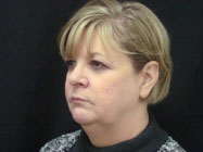 Palmgren Acupuncture - Before Facial Rejuvenation