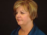 Palmgren Acupuncture - After 10 Sessions of Facial Rejuvenation